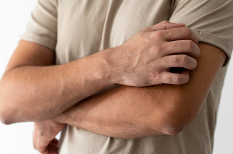 Histamine Intolerance Add-on: DNA Test