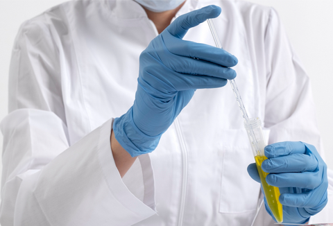 HuMap Urine Test - Hormone & Urinary Profile - Doctors Data Labs