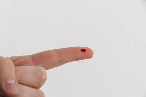 PSA Blood Test – Check Prostate Health with a Simple Finger Prick